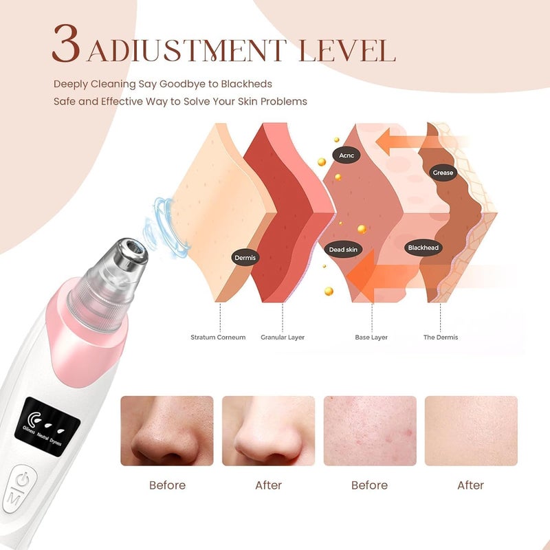 Gackoko 2025 Blackhead Remover Pore Vacuum,Facial Pore Cleaner-5 Suction Power,5 Probes,USB Rechargeable Blackhead Vacuum Kit Electric Acne Extractor Tool for Adult - Image 2